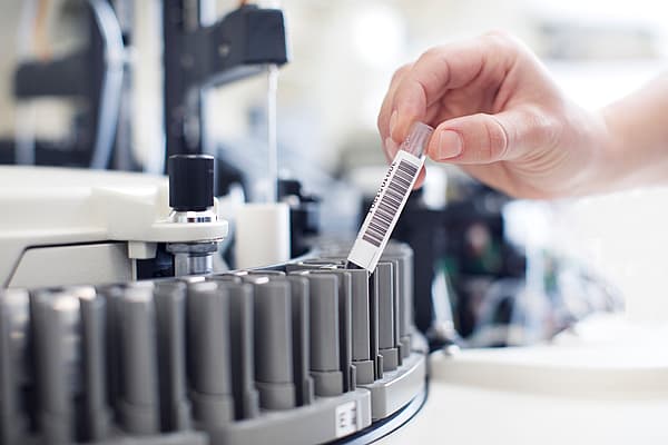 En hånd som holder et reagensrør.